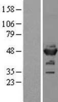 Western Blot: Enolase 2/Neuron-specific Enolase Overexpression Lysate [NBL1-10268]