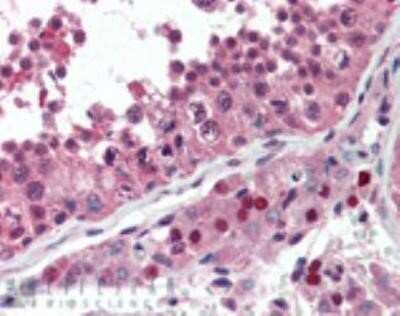 Immunohistochemistry: NSF Antibody (9G7-3) [NBP1-19333]