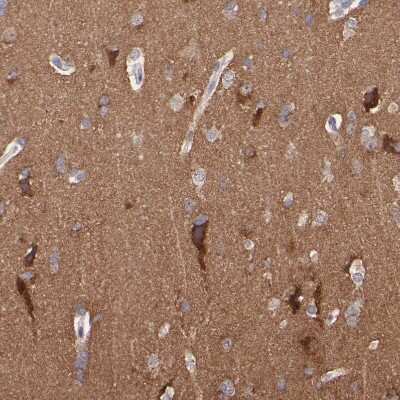 Immunohistochemistry-Paraffin: NSF Antibody [NBP1-87035]