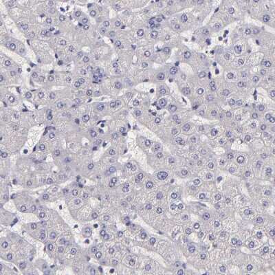 Immunohistochemistry-Paraffin: NSF Antibody [NBP1-87035]