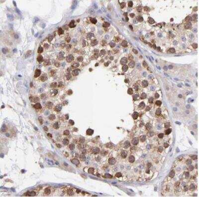 Immunohistochemistry-Paraffin: NSF Antibody [NBP1-87035]