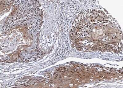 Immunohistochemistry-Paraffin: NSFL1C Antibody [NBP1-31402]