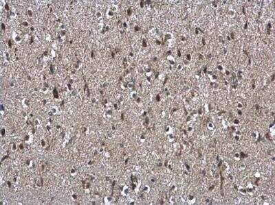 Immunohistochemistry-Paraffin: NSFL1C Antibody [NBP1-31402]