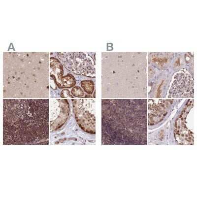 Immunohistochemistry-Paraffin: NSFL1C Antibody [NBP2-13677]