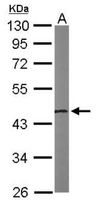 Western Blot: NSFL1C Antibody [NBP1-31402]