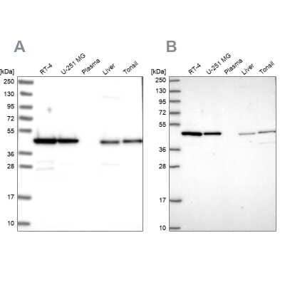 Western Blot: NSFL1C Antibody [NBP2-13676]