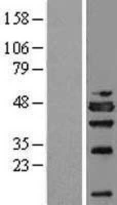 Western Blot: NSFL1C Overexpression Lysate [NBL1-13809]