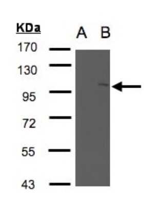 Western Blot: NSMAF Antibody [NBP1-31431]