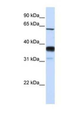 Western Blot: SMPD3/NSMase2 Antibody [NBP1-69344]