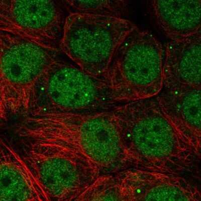 Immunocytochemistry/ Immunofluorescence: NSMCE1 Antibody [NBP1-92201]