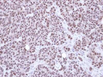 Immunohistochemistry-Paraffin: NSMCE1 Antibody [NBP1-32527]