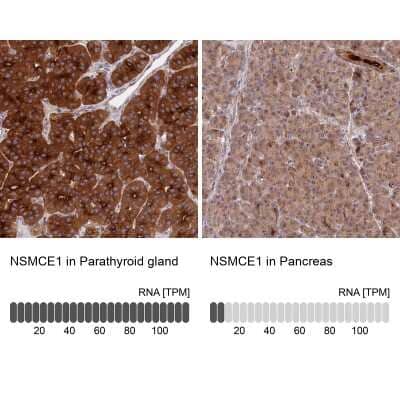 Immunohistochemistry-Paraffin: NSMCE1 Antibody [NBP1-92200]