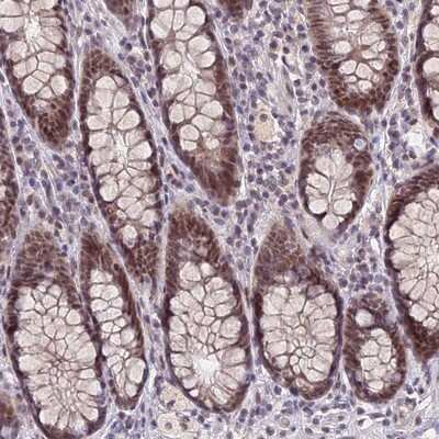 Immunohistochemistry-Paraffin: NSMCE1 Antibody [NBP1-92201]