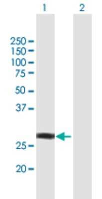 Western Blot: NSMCE1 Antibody [H00197370-B01P]