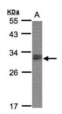 Western Blot: NSMCE1 Antibody [NBP1-32527]