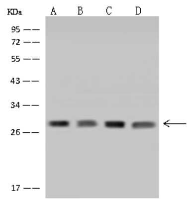 Western Blot: NSMCE1 Antibody [NBP2-98533]