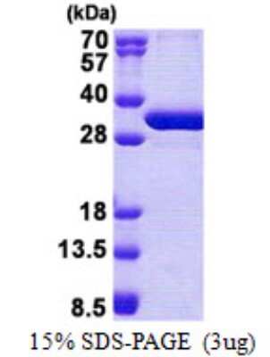 SDS-PAGE: Recombinant Human NSMCE1 His Protein [NBP2-23292]