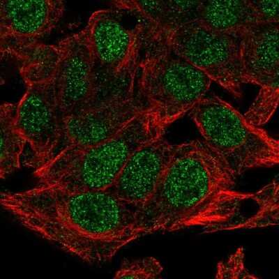 Immunocytochemistry/ Immunofluorescence: NSMCE4A Antibody [NBP2-55592]