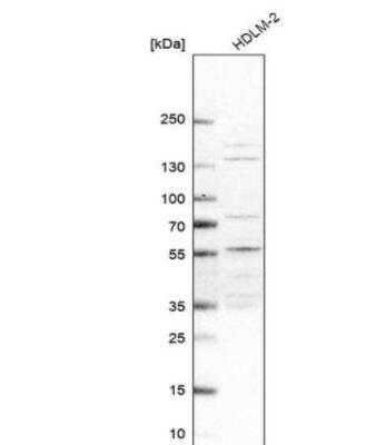 Western Blot: NSMCE4A Antibody [NBP1-90789]