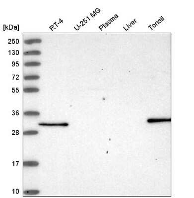 Western Blot: NSMCE4A Antibody [NBP2-55189]