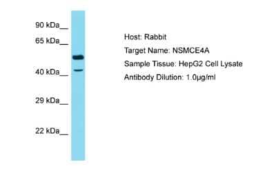 Western Blot: NSMCE4A Antibody [NBP2-87946]