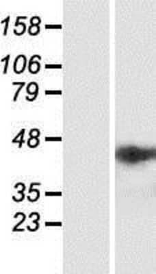 Western Blot: NSMCE4A Overexpression Lysate [NBP2-06957]