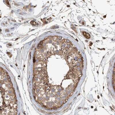 Immunohistochemistry-Paraffin: NSP 5 alpha 3 alpha Antibody [NBP1-85352]
