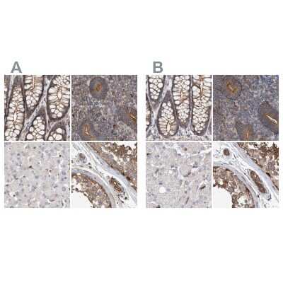 Immunohistochemistry-Paraffin: NSP 5 alpha 3 alpha Antibody [NBP1-85352]
