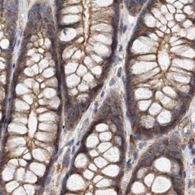 Immunohistochemistry-Paraffin: NSP 5 alpha 3 alpha Antibody [NBP1-85352]