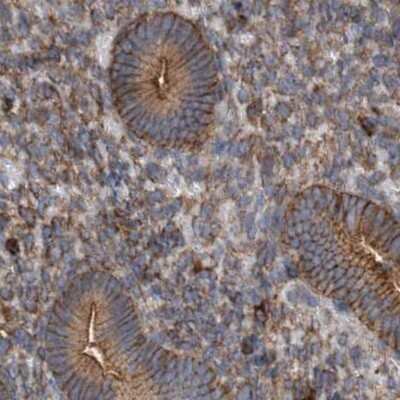 Immunohistochemistry-Paraffin: NSP 5 alpha 3 alpha Antibody [NBP1-85352]