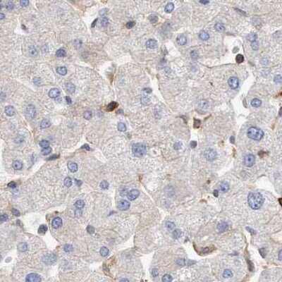Immunohistochemistry-Paraffin: NSP 5 alpha 3 alpha Antibody [NBP1-85352]
