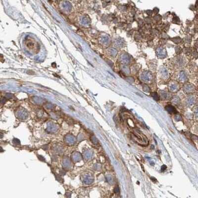 Immunohistochemistry-Paraffin: NSP 5 alpha 3 alpha Antibody [NBP1-85352]