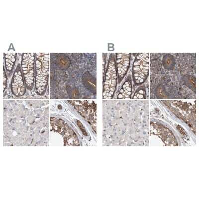 Immunohistochemistry-Paraffin: NSP 5 alpha 3 alpha Antibody [NBP1-85353]