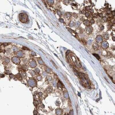 Immunohistochemistry-Paraffin: NSP 5 alpha 3 alpha Antibody [NBP1-85353]