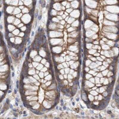 Immunohistochemistry-Paraffin: NSP 5 alpha 3 alpha Antibody [NBP1-85353]