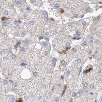 Immunohistochemistry-Paraffin: NSP 5 alpha 3 alpha Antibody [NBP1-85353]