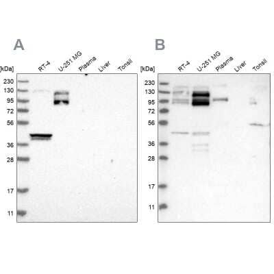 Western Blot: NSP 5 alpha 3 alpha Antibody [NBP1-85352]