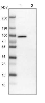 Western Blot: NSP 5 alpha 3 alpha Antibody [NBP1-85353]