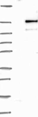 Western Blot: NSP 5 alpha 3 alpha Antibody [NBP3-17187]