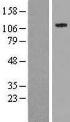 Western Blot: NSP 5 alpha 3 alpha Overexpression Lysate [NBP2-11599]