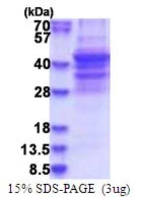 SDS-PAGE: Recombinant Human NSP 5 alpha 3 alpha His Protein [NBP2-51745]