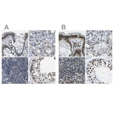 Immunohistochemistry-Paraffin: NSRP1 Antibody [NBP1-90547]