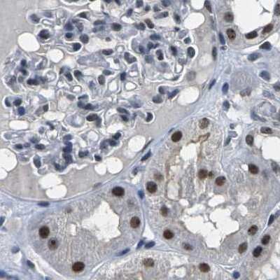 Immunohistochemistry-Paraffin: NSRP1 Antibody [NBP1-90547]