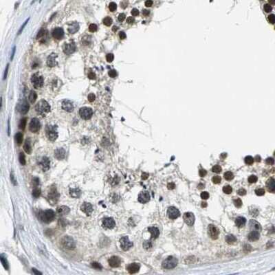 Immunohistochemistry-Paraffin: NSRP1 Antibody [NBP1-90547]