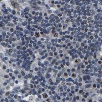 Immunohistochemistry-Paraffin: NSRP1 Antibody [NBP1-90547]