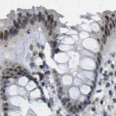 Immunohistochemistry-Paraffin: NSRP1 Antibody [NBP1-90547]