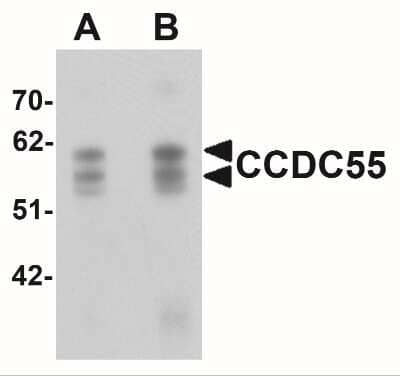 Western Blot: NSRP1 AntibodyBSA Free [NBP2-41139]