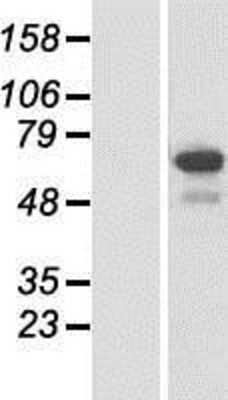 Western Blot: NSRP1 Overexpression Lysate [NBP2-06077]