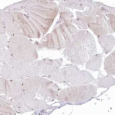 Immunohistochemistry-Paraffin: NSUN2 Antibody [NBP1-82189]