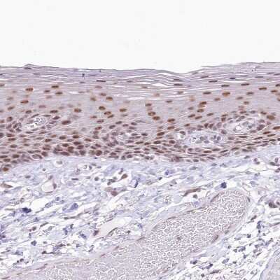Immunohistochemistry-Paraffin: NSUN2 Antibody [NBP1-82189]